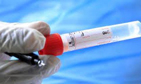 Активните случаи минаха 72 хиляди, скок на тестовете и ваксинациите - 1