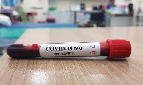 130 нови случаи на заразени с Covid-19 в България за изминалото денонощие - 1