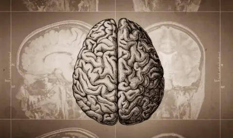 Учени: Повишената тревожност издава "презрял" мозък - 1