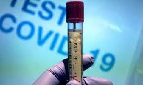 40 с коронавирус починаха в неделя, четирима от тях са ваксинирани - 1