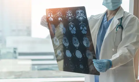  Пандемията от коронавирус е ускорила стареенето на мозъка - 1