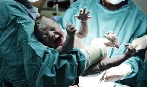 Бебе-русалка се роди в Индия - 1