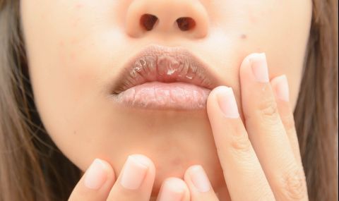 Сухите и напукани устни могат да сигнализират за сериозни проблеми - 1