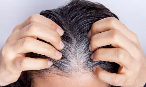 Учени откриха на какво се дължи ранното побеляване на косата - 1