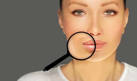 Лекар развенча митове за окосмяването на женското лице - 1