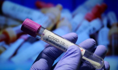 COVID-19 в България: 36 заразени за последното денонощие, 1 жертва - 1