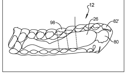 Ford патентова въздушна възглавница за спящи пасажери - 1