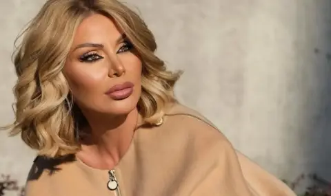 Светлана Василева се оплака от алергична реакция към разкрасителна процедура (ВИДЕО) - 1