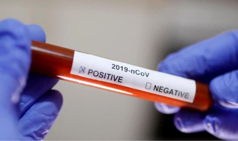 1 701 нови случая на коронавирус, починаха шестима - 1