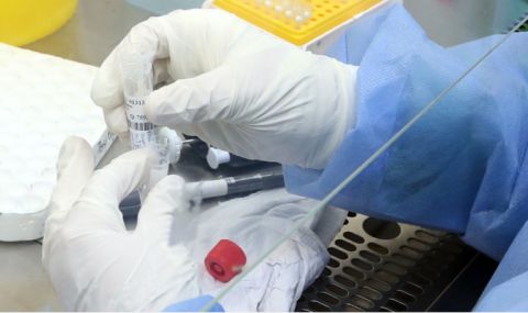 84 нови случая на коронавирус, почина един пациент - 1