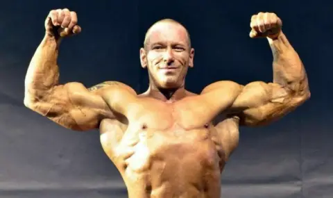 Заради стероиди: Месоядна бактерия уби прочут италиански бодибилдър - 1