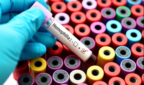 Близо 800 души у нас страдат от хемофилия - 1
