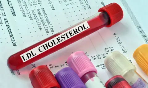 Кардиолог посочи най-масовите митове за холестерола - 1