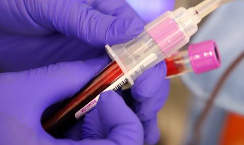  Бум на нови заразени в Стара Загора - 1