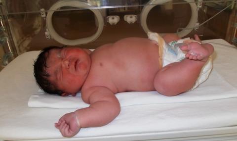 Бебе с рекордно тегло се роди в Пловдив - 1