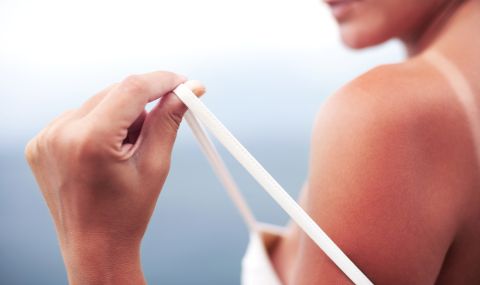 Слънчево изгаряне - 5 натурални лека, с които да успокоите кожата - 1