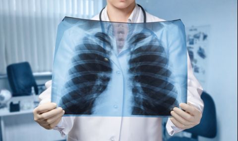 Как да разпознаем рано рака на белите дробове - 1