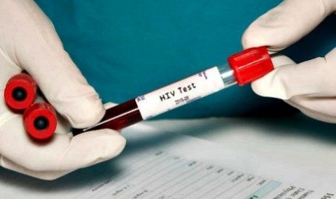 Нова надежда за лек срещу ХИВ - 1