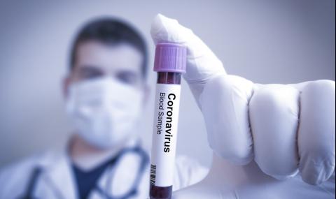 До дни наши лаборатории ще правят бързи тестове за коронавирус - 1