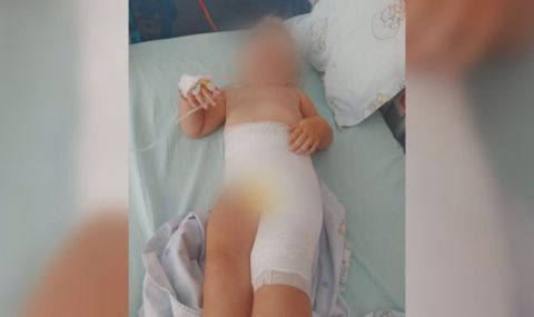 2-годишно получи изгаряне в столична детска ясла - 1