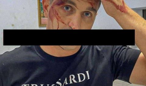В окупирания Мариупол удариха с лост по главата руски политик - 1