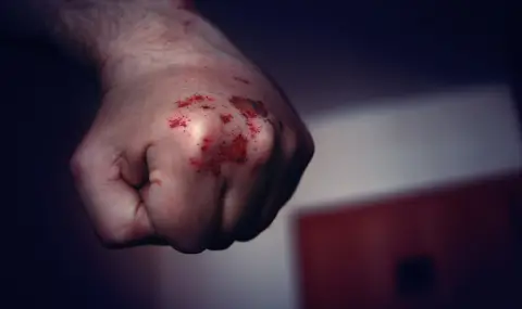 Мъж е със счупен череп след побой - 1