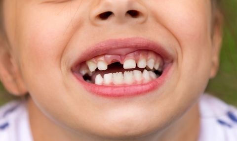 Защо да съхраняваме млечните зъби на детето? - 1