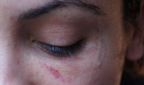 Диана Димитрова публикува снимки, показващи физическо насилие върху нея - 1