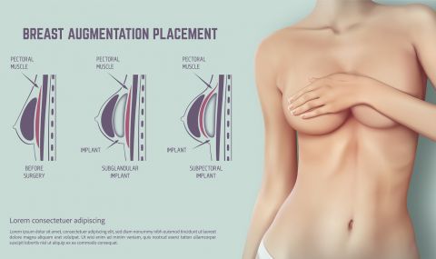 Ето кои жени не трябва да си слагат силикон според руски мамолог - 1