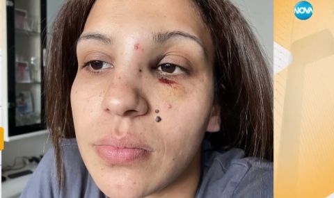 Жена твърди, че е пребита от бившия си пред детето им - 1