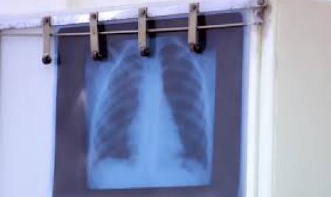 София и Благоевград с най-много заразени за денонощието - 1