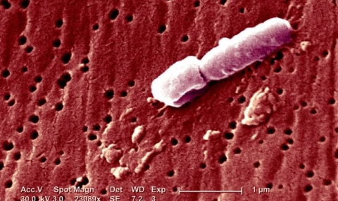 Смъртоносните супер бактерии вече са тук - 1