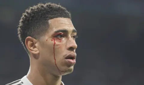 Окървавеният Белингам с картон предизвика лавина от негативни реакции - 1