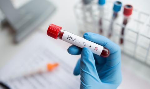 Надежда: Бразилец може да се окаже първият излекуван от ХИВ - 1