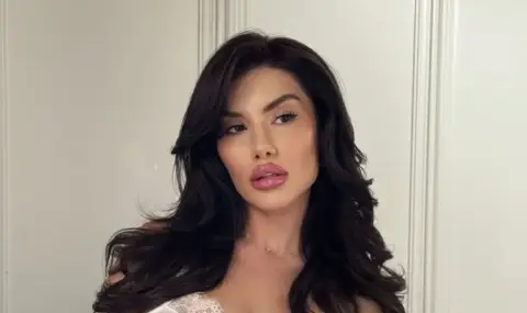 Пламена от "Ергенът" показа СНИМКА отпреди 10 години и преди корекциите  - 1