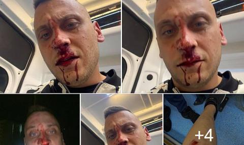 Пребиха лидер на контрапротеста - 1