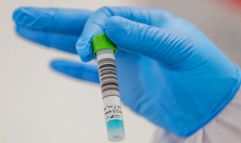 287 нови случая на коронавирус, починаха още 4-ма заразени - 1