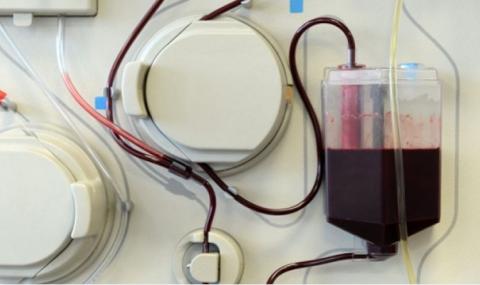 Сдружение иска кръвни центрове в страната, за да няма дефицит на плазма  - 1