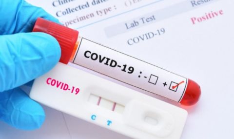 301 нови заразени, починаха още петима с коронавирус - 1