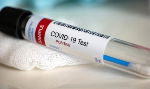 44 случая на COVID-19 за последното денонощие - 1
