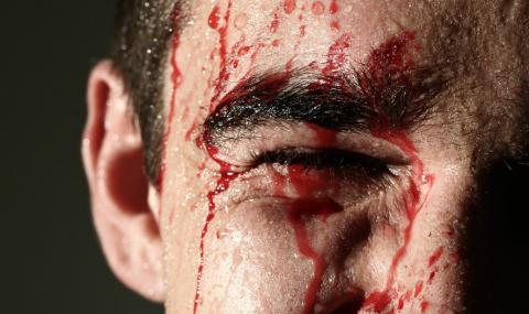 Шестима в болница след бой пред дискотека - 1