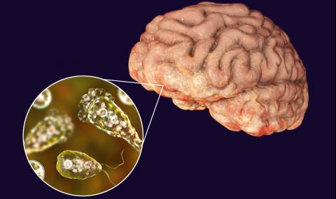 Нова жертва на ядящата човешки мозък амеба - 1