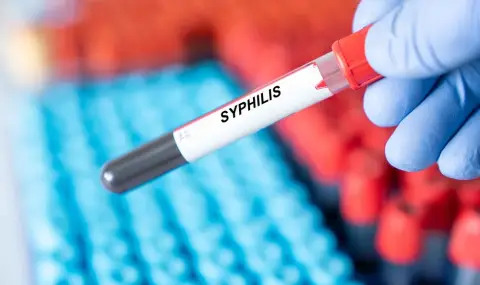Бум на сифилис в България! В Монтана и новородено е с венерическата болест - 1