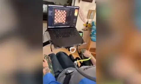Първият чипиран с Neuralink човек показва как играе шах на компютър с ума си (ВИДЕО) - 1