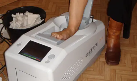 Профилактиката за остеопороза е важна, но се подценява - 1