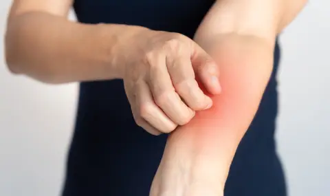 Жена сподели ранни симптоми на рак, които е пренебрегнала - 1