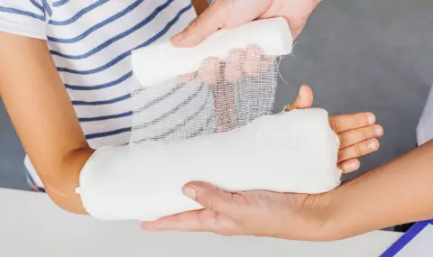 Революционно изобретение: Създадоха лепило за счупени кости - 1