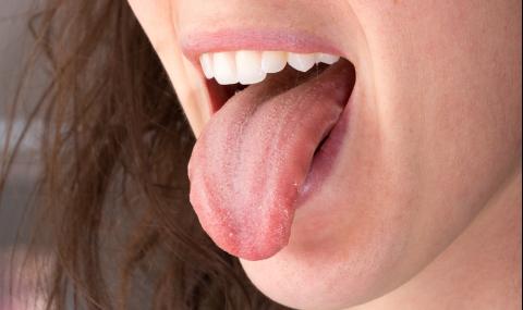 Ако видите това по езика си... - 1