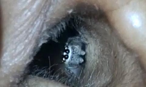 Стряскащо видео показа жив паяк да изпълзява от ухото на жена (ВИДЕО) - 1