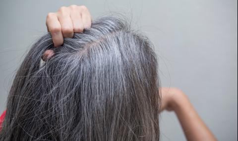 Имунната система е виновна за побеляването на косите ни - 1